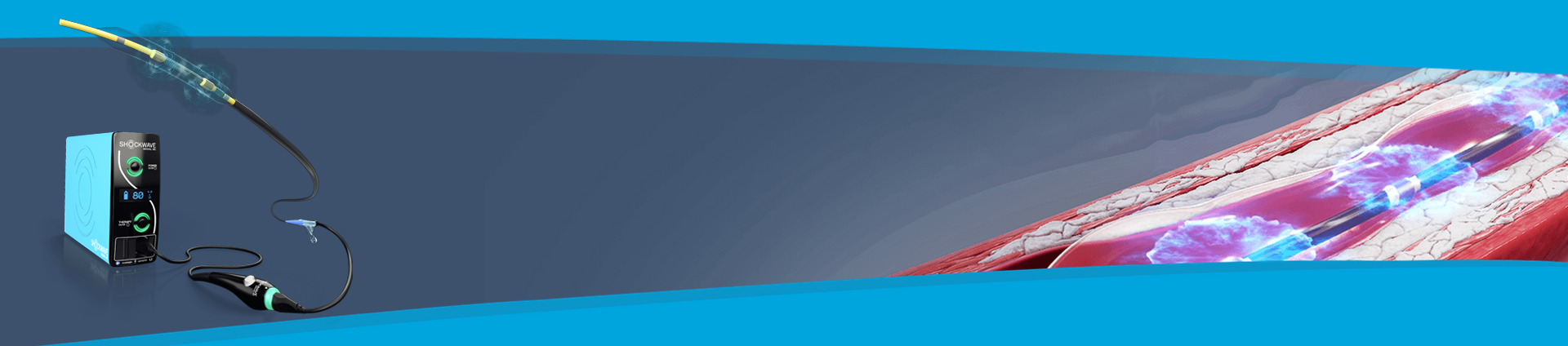 Shockwave Image